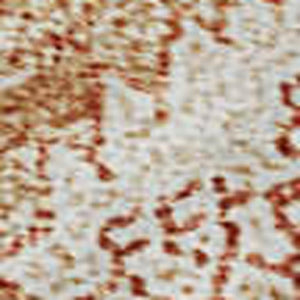 HomeRoots 10' X 14' Salmon and Ivory Damask Washable Area Rug - Durable, UV Protected, and Elegant Design! 683920