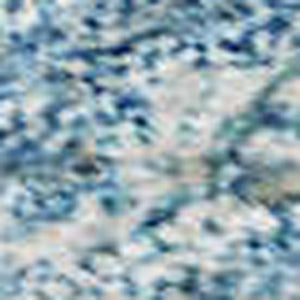 HomeRoots 5' X 8' Sky Blue & Ivory Damask Rug - Washable, UV-Protected, Stylish & Durable for Busy Homes 683922